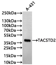 Western Blot
Positive WB detected in: A-431 whole cell lysate(30µg)
All lanes: TACSTD2 antibody at 1:1000
Secondary
Goat polyclonal to mouse IgG at 1/40000 dilution
Predicted band size: 36 kDa
Observed band size: 36 kDa
Exposure time: 2min