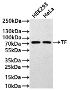 Western Blot
Positive WB detected in: HEK293 whole cell lysate(30µg) ) , Hela whole cell lysate(30µg) 
All lanes: TF antibody at 1:1000
Secondary
Goat polyclonal to human IgG at 1/40000 dilution
Predicted band size: 77 kDa
Observed band size: 77 kDa
Exposure time: 5min