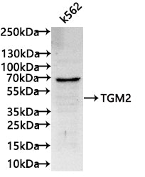 Western Blot
Positive WB detected in:K562 whole cell lysate(30µg)
All lanes:TGM2 antibody at 1:1000
Secondary
Goat polyclonal to human IgG at 1/40000 dilution
Predicted band size: 77.329、61.678、38.671 kDa
Observed band size: 62 kDa
Exposure time: 3min