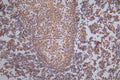 IHC image of CSB-RA008642MA1HU diluted at 1:50 and staining in paraffin-embedded human tonsil tissue performed on a Leica BondTM system. After dewaxing and hydration,  antigen retrieval was mediated by high pressure in a citrate buffer (pH 6.0) . Section was blocked with 10% normal goat serum 30min at RT. Then primary antibody (1% BSA) was incubated at 4°C overnight. The primary is detected by a Goat anti-Rabbit IgG labeled by HRP and visualized using 0.05% DAB.