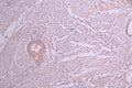 IHC image of CSB-RA023954MA1HU diluted at 1:50 and staining in paraffin-embedded human cervical cancer performed on a Leica BondTM system. After dewaxing and hydration, antigen retrieval was mediated by high pressure in a citrate buffer (pH 6.0) . Section was blocked with 10% normal goat serum 30min at RT. Then primary antibody (1% BSA) was incubated at 4°C overnight. The primary is detected by a Anti-Human lgG, Fcy Fragment Specific labeled by HRP and visualized using 0.05% DAB.