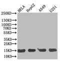 Western Blot
Positive WB detected in: Hela whole cell lysate, HepG2 whole cell lysate, A549 whole cell lysate, U251 whole cell lysate
All lanes: TNFRSF10B antibody at 1:500
Secondary
Goat polyclonal to Human IgG at 1/50000 dilution
Predicted band size: 13 kDa
Observed band size: 13 kDa