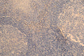 IHC image of CSB-RA023981MA1HU diluted at 1:200 and staining in paraffin-embedded human tonsil tissue performed on a Leica BondTM system. After dewaxing and hydration, antigen retrieval was mediated by high pressure in a citrate buffer (pH 6.0) . Section was blocked with 10% normal goat serum 30min at RT. Then primary antibody (1% BSA) was incubated at 4°C overnight. The primary is detected by a Goat anti-human polymer IgG labeled by HRP and visualized using 0.05% DAB.