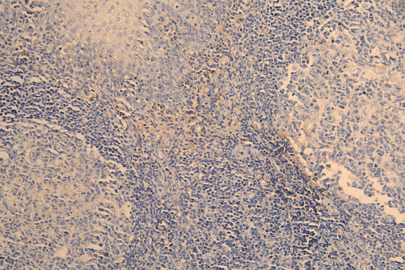 IHC image of CSB-RA023981MA1HU diluted at 1:200 and staining in paraffin-embedded human tonsil tissue performed on a Leica BondTM system. After dewaxing and hydration, antigen retrieval was mediated by high pressure in a citrate buffer (pH 6.0) . Section was blocked with 10% normal goat serum 30min at RT. Then primary antibody (1% BSA) was incubated at 4°C overnight. The primary is detected by a Goat anti-human polymer IgG labeled by HRP and visualized using 0.05% DAB.