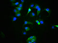 Immunofluorescence staining of MCF-7 cells with CSB-RA024077A09phHU at 1:100,counter-stained with DAPI. The cells were fixed in 4% formaldehyde, permeabilized using 0.2% Triton X-100 and blocked in 10% normal Goat Serum. The cells were then incubated with the antibody overnight at 4℃. The secondary antibody was Alexa Fluor 488-congugated AffiniPure Goat Anti-Rabbit IgG (H+L) .