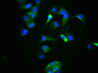 Immunofluorescence staining of MCF-7 cells with CSB-RA024077A09phHU at 1:100,counter-stained with DAPI. The cells were fixed in 4% formaldehyde, permeabilized using 0.2% Triton X-100 and blocked in 10% normal Goat Serum. The cells were then incubated with the antibody overnight at 4℃. The secondary antibody was Alexa Fluor 488-congugated AffiniPure Goat Anti-Rabbit IgG (H+L) .