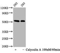Western Blot
Positive WB detected in: 293 whole cell lysate(treated with Calyculin A or not) 
All lanes: Phospho-TP53 antibody at 0.64μg/ml
Secondary
Goat polyclonal to rabbit IgG at 1/50000 dilution
Predicted band size: 53 KDa
Observed band size: 53 KDa