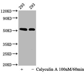 Western Blot
Positive WB detected in: 293 whole cell lysate(treated with Calyculin A or not) 
All lanes: Phospho-TP53 antibody at 0.64μg/ml
Secondary
Goat polyclonal to rabbit IgG at 1/50000 dilution
Predicted band size: 53 KDa
Observed band size: 53 KDa