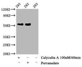Western Blot
Positive WB detected in 293 whole cell lysate(treated with Calyculin A or Pervanadate) 
All lanes Phospho-TP53 antibody at 1.28μg/ml
Secondary
Goat polyclonal to rabbit IgG at 1/50000 dilution
Predicted band size: 53 KDa
Observed band size: 53 KDa