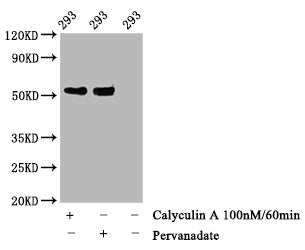 Western Blot
Positive WB detected in 293 whole cell lysate(treated with Calyculin A or Pervanadate) 
All lanes Phospho-TP53 antibody at 1.28μg/ml
Secondary
Goat polyclonal to rabbit IgG at 1/50000 dilution
Predicted band size: 53 KDa
Observed band size: 53 KDa