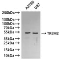 Western Blot
Positive WB detected in: A2780 whole cell lysate(30µg),U87 whole cell lysate(30µg)
All lanes: TREM2 antibody at 1:1000
Secondary
Goat polyclonal to human IgG at 1/40000 dilution
Predicted band size: 25.447,24.328,24,669 kDa
Observed band size: 50 kDa
Exposure time: 120s
