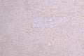 IHC image of CSB-RA025141MA1HU diluted at 1：100 and staining in paraffin-embedded human liver tissue performed on a Leica BondTM system. After dewaxing and hydration, antigen retrieval was mediated by high pressure in a citrate buffer (pH 6.0) . Section was blocked with 10% normal goat serum 30min at RT. Then primary antibody (1% BSA) was incubated at 4°C overnight. The primary is detected by a Goat anti-human polymer IgG labeled by HRP and visualized using 0.05% DAB.