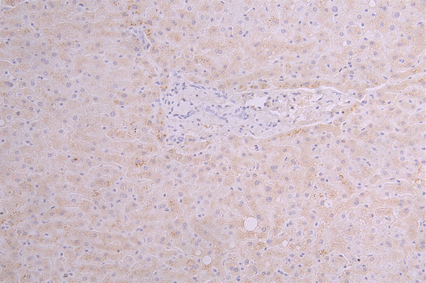 IHC image of CSB-RA025141MA1HU diluted at 1：100 and staining in paraffin-embedded human liver tissue performed on a Leica BondTM system. After dewaxing and hydration, antigen retrieval was mediated by high pressure in a citrate buffer (pH 6.0) . Section was blocked with 10% normal goat serum 30min at RT. Then primary antibody (1% BSA) was incubated at 4°C overnight. The primary is detected by a Goat anti-human polymer IgG labeled by HRP and visualized using 0.05% DAB.