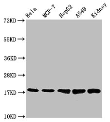 Western Blot
Positive WB detected in: Hela whole cell lysate, MCF-7 whole cell lysate, HepG2 whole cell lysate, A549 whole cell lysate, Mouse kidney tissue
All lanes: PBR antibody at 1.2μg/ml
Secondary
Goat polyclonal to rabbit IgG at 1/50000 dilution
Predicted band size: 19, 11 KDa
Observed band size: 19 KDa