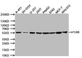 Western Blot
Positive WB detected in:A431 whole cell lysate (20µg) , SH-SY5Y whole cell lysate (20µg) , U251 whole cell lysate (20µg) , 293T whole cell lysate (20µg) , HepG2 whole cell lysate (20µg) , K562 whole cell lysate (20µg) , MCF7 whole cell lysate (20µg) , NIH/3T3 whole cell lysate (20µg) 
All lanes: TUBB antibody at 1:1000
Secondary
Goat polyclonal to human IgG at 1/40000 dilution
Predicted band size:49 kDa
Observed band size:55 kDa
Exposure time:5s
