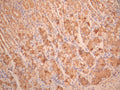 IHC image of CSB-RA025342MA1HU diluted at 1:50 and staining in paraffin-embedded human stomach tissue performed on a Leica BondTM system. After dewaxing and hydration, antigen retrieval was mediated by high pressure in a citrate buffer (pH 6.0). Section was blocked with 10% normal goat serum 30min at RT. Then primary antibody (1% BSA) was incubated at 4°C overnight. The primary is detected by a Anti-Human lgG, Fcy Fragment Specific labeled by HRP and visualized using 0.05% DAB.