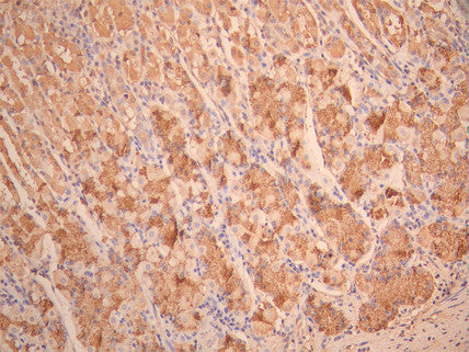 IHC image of CSB-RA025342MA1HU diluted at 1:50 and staining in paraffin-embedded human stomach tissue performed on a Leica BondTM system. After dewaxing and hydration, antigen retrieval was mediated by high pressure in a citrate buffer (pH 6.0). Section was blocked with 10% normal goat serum 30min at RT. Then primary antibody (1% BSA) was incubated at 4°C overnight. The primary is detected by a Anti-Human lgG, Fcy Fragment Specific labeled by HRP and visualized using 0.05% DAB.