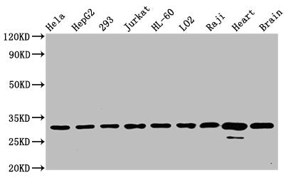 Western Blot
Positive WB detected in: Hela whole cell lysate, HepG2 whole cell lysate, 293 whole cell lysate, Jurkat whole cell lysate, HL-60 whole cell lysate, LO2 whole cell lysate, Raji whole cell lysate, Rat heart tissue, Mouse brain tissue
All lanes: VDAC1 antibody at 0.7μg/ml
Secondary
Goat polyclonal to rabbit IgG at 1/50000 dilution
Predicted band size: 31 KDa
Observed band size: 31 KDa