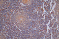 IHC image of CSB-RA025857MA1HU diluted at 1:40 and staining in paraffin-embedded human tonsil tissue performed on a Leica BondTM system. After dewaxing and hydration,  antigen retrieval was mediated by high pressure in a citrate buffer (pH 6.0) . Section was blocked with 10% normal goat serum 30min at RT. Then primary antibody (1% BSA) was incubated at 4°C overnight. The primary is detected by a Goat anti-Rabbit IgG labeled by HRP and visualized using 0.05% DAB.