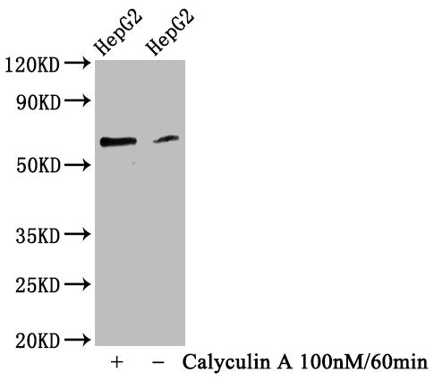 Western Blot
Positive WB detected in HepG2 whole cell lysate(treated with Calyculin A or not) 
All lanes Phospho-YAP1 antibody at 0.83μg/ml
Secondary
Goat polyclonal to rabbit IgG at 1/50000 dilution
Predicted band size: 65 KDa
Observed band size: 65 KDa