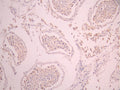 IHC image of CSB-RA027547A0HU diluted at 1:100 and staining in paraffin-embedded human testis tissue performed on a Leica BondTM system. After dewaxing and hydration, antigen retrieval was mediated by high pressure in a citrate buffer (pH 6.0). Section was blocked with 10% normal goat serum 30min at RT. Then primary antibody (1% BSA) was incubated at 4°C overnight. The primary is detected by a Goat anti-rabbit polymer IgG labeled by HRP and visualized using 0.05% DAB.