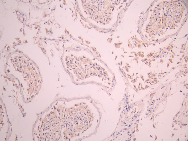 IHC image of CSB-RA027547A0HU diluted at 1:100 and staining in paraffin-embedded human testis tissue performed on a Leica BondTM system. After dewaxing and hydration, antigen retrieval was mediated by high pressure in a citrate buffer (pH 6.0). Section was blocked with 10% normal goat serum 30min at RT. Then primary antibody (1% BSA) was incubated at 4°C overnight. The primary is detected by a Goat anti-rabbit polymer IgG labeled by HRP and visualized using 0.05% DAB.