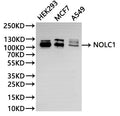 Western Blot
Positive WB detected in: HEK293 whole cell lysate(30µg), MCF-7 whole cell lysate(30µg), A549 whole cell lysate(30µg)
All lanes: NOLC1 antibody at 1:1000
Secondary
Goat polyclonal to rabbit IgG at 1/40000 dilution
Predicted band size: 74 kDa
Observed band size: 110 kDa
Exposure time：1min