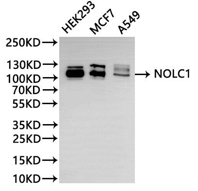 Western Blot
Positive WB detected in: HEK293 whole cell lysate(30µg), MCF-7 whole cell lysate(30µg), A549 whole cell lysate(30µg)
All lanes: NOLC1 antibody at 1:1000
Secondary
Goat polyclonal to rabbit IgG at 1/40000 dilution
Predicted band size: 74 kDa
Observed band size: 110 kDa
Exposure time：1min