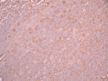 IHC image of CSB-RA028490A0HU diluted at 1:100 and staining in paraffin-embedded human tonsil tissue performed on a Leica BondTM system. After dewaxing and hydration, antigen retrieval was mediated by high pressure in a citrate buffer (pH 6.0). Section was blocked with 10% normal goat serum 30min at RT. Then primary antibody (1% BSA) was incubated at 4°C overnight. The primary is detected by a Goat anti-rabbit polymer IgG labeled by HRP and visualized using 0.05% DAB.