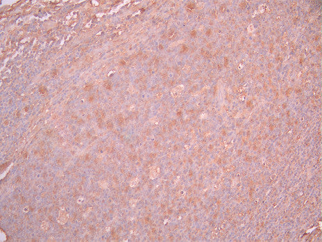 IHC image of CSB-RA028490A0HU diluted at 1:100 and staining in paraffin-embedded human tonsil tissue performed on a Leica BondTM system. After dewaxing and hydration, antigen retrieval was mediated by high pressure in a citrate buffer (pH 6.0). Section was blocked with 10% normal goat serum 30min at RT. Then primary antibody (1% BSA) was incubated at 4°C overnight. The primary is detected by a Goat anti-rabbit polymer IgG labeled by HRP and visualized using 0.05% DAB.