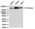 Western Blot, 
Positive WB detected in:MCF7 whole cell lysate(30µg), Jurkat whole cell lysate(30µg), THP-1 whole cell lysate(30µg)
All lanes: Timeless antibody at 1:1000
Secondary
Goat polyclonal to rabbit IgG at 1/40000 dilution
Predicted band size: 139 kDa
Observed band size: 150 kDa
Exposure time：120s