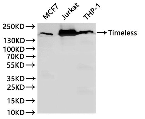 Western Blot, 
Positive WB detected in:MCF7 whole cell lysate(30µg), Jurkat whole cell lysate(30µg), THP-1 whole cell lysate(30µg)
All lanes: Timeless antibody at 1:1000
Secondary
Goat polyclonal to rabbit IgG at 1/40000 dilution
Predicted band size: 139 kDa
Observed band size: 150 kDa
Exposure time：120s