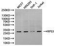 Western Blot, 
Positive WB detected in:MCF7 whole cell lysate(30µg), HEK293 whole cell lysate(30µg), THP-1 whole cell lysate(30µg), Jurkat whole cell lysate(30µg)
All lanes: RPS3 antibody at 1:1000
Secondary
Goat polyclonal to rabbit IgG at 1/40000 dilution
Predicted band size: 27 kDa
Observed band size: 27 kDa
Exposure time：180s
