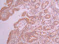 IHC image of CSB-RA033218A0HU diluted at 1:100 and staining in paraffin-embedded human small intestine tissue performed on a Leica BondTM system. After dewaxing and hydration, antigen retrieval was mediated by high pressure in a citrate buffer (pH 6.0) . Section was blocked with 10% normal goat serum 30min at RT. Then primary antibody (1% BSA) was incubated at 4°C overnight. The primary is detected by a Goat anti-rabbit polymer IgG labeled by HRP and visualized using 0.05% DAB.