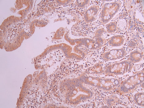 IHC image of CSB-RA033218A0HU diluted at 1:100 and staining in paraffin-embedded human small intestine tissue performed on a Leica BondTM system. After dewaxing and hydration, antigen retrieval was mediated by high pressure in a citrate buffer (pH 6.0) . Section was blocked with 10% normal goat serum 30min at RT. Then primary antibody (1% BSA) was incubated at 4°C overnight. The primary is detected by a Goat anti-rabbit polymer IgG labeled by HRP and visualized using 0.05% DAB.