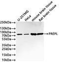 Western Blot
Positive WB detected in: U-251MG whole cell lysate(30µg) , HeLa whole cell lysate(30µg) , Mouse brain tissue lysate(30µg) , Rat brain tissue lysate(30µg) 
All lanes: PREPL antibody at 1:1000
Secondary
Goat polyclonal to rabbit IgG at 1/40000 dilution
Predicted band size: 84 kDa
Observed band size: 84 kDa
Exposure time：2min