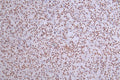 IHC image of CSB-RA034362A0HU diluted at 1:50 and staining in paraffin-embedded human pancreati  tissue performed on a Leica BondTM system. After dewaxing and hydration, antigen retrieval was mediated by high pressure in a citrate buffer (pH 6.0) . Section was blocked with 10% normal goat serum 30min at RT. Then primary antibody (1% BSA) was incubated at 4°C overnight. The primary is detected by a Goat anti-rabbit polymer IgG labeled by HRP and visualized using 0.27% DAB.