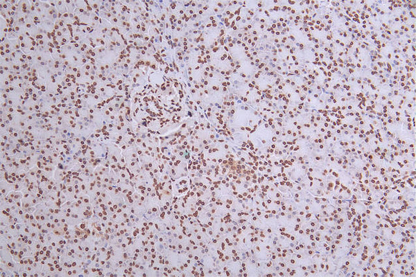 IHC image of CSB-RA034362A0HU diluted at 1:50 and staining in paraffin-embedded human pancreati  tissue performed on a Leica BondTM system. After dewaxing and hydration, antigen retrieval was mediated by high pressure in a citrate buffer (pH 6.0) . Section was blocked with 10% normal goat serum 30min at RT. Then primary antibody (1% BSA) was incubated at 4°C overnight. The primary is detected by a Goat anti-rabbit polymer IgG labeled by HRP and visualized using 0.27% DAB.
