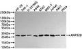 Western Blot
Positive WB detected in: HT-29 whole cell lysate(30µg) , THP-1 whole cell lysate(30µg) , U-251MG whole cell lysate(30µg) , A549 whole cell lysate(30µg) , K562 whole cell lysate(30µg) , MCF-7 whole cell lysate(30µg) , Jurkat whole cell lysate(30µg) , A431 whole cell lysate(30µg) , HeLa whole cell lysate(30µg) 
All lanes: ANP32B antibody at 1:1000
Secondary
Goat polyclonal to rabbit IgG at 1/40000 dilution
Predicted band size: 29 kDa
Observed band size: 29 kDa
Exposure time：30s