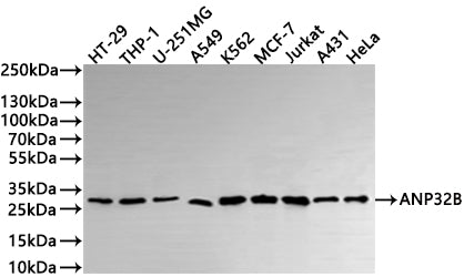 Western Blot
Positive WB detected in: HT-29 whole cell lysate(30µg) , THP-1 whole cell lysate(30µg) , U-251MG whole cell lysate(30µg) , A549 whole cell lysate(30µg) , K562 whole cell lysate(30µg) , MCF-7 whole cell lysate(30µg) , Jurkat whole cell lysate(30µg) , A431 whole cell lysate(30µg) , HeLa whole cell lysate(30µg) 
All lanes: ANP32B antibody at 1:1000
Secondary
Goat polyclonal to rabbit IgG at 1/40000 dilution
Predicted band size: 29 kDa
Observed band size: 29 kDa
Exposure time：30s