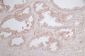 IHC image of CSB-RA037143A0HU diluted at 1:100 and staining in paraffin-embedded human prostate tissue performed on a Leica BondTM system. After dewaxing and hydration, antigen retrieval was mediated by high pressure in a citrate buffer (pH 6.0) . Section was blocked with 10% normal goat serum 30min at RT. Then primary antibody (1% BSA) was incubated at 4°C overnight. The primary is detected by a Goat anti-rabbit polymer IgG labeled by HRP and visualized using 0.77% DAB.