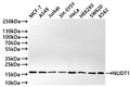 Western Blot
Positive WB detected in: MCF-7 whole cell lysate(30µg) , A549 whole cell lysate(30µg) , Jurkat whole cell lysate(30µg) , SH-SY5Y whole cell lysate(30µg) , HeLa whole cell lysate(30µg) , HEK293 whole cell lysate(30µg) , SW620 whole cell lysate(30µg) , K562 whole cell lysate(30µg) 
All lanes: NUDT1 antibody at 1:1000
Secondary
Goat polyclonal to rabbit IgG at 1/50000 dilution
Predicted band size: 18 kDa
Observed band size: 18 kDa
Exposure time: 3min