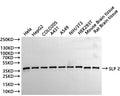 Western Blot
Positive WB detected in: Hela whole cell lysate(30µg), HepG2 whole cell lysate(30µg), COLO-205 whole cell lysate(30µg), A431 whole cell lysate(30µg), A549 whole cell lysate(30µg), SH-SY5Y whole cell lysate(30µg), HEK293T whole cell lysate(30µg), Mouse brain tissue lysate(30µg), Rat brain tissue lysate(30µg)
All lanes:SLP 2 antibody at 1:1000
Secondary
Goat polyclonal to rabbit IgG at 1/40000 dilution
Predicted band size: 39 kDa
Observed band size: 39 kDa
Exposure time：30s