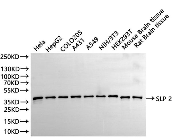 Western Blot
Positive WB detected in: Hela whole cell lysate(30µg), HepG2 whole cell lysate(30µg), COLO-205 whole cell lysate(30µg), A431 whole cell lysate(30µg), A549 whole cell lysate(30µg), SH-SY5Y whole cell lysate(30µg), HEK293T whole cell lysate(30µg), Mouse brain tissue lysate(30µg), Rat brain tissue lysate(30µg)
All lanes:SLP 2 antibody at 1:1000
Secondary
Goat polyclonal to rabbit IgG at 1/40000 dilution
Predicted band size: 39 kDa
Observed band size: 39 kDa
Exposure time：30s