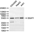 Western Blot, 
Positive WB detected in:COLO205 whole cell lysate(30µg), HepG2 whole cell lysate(30µg), A431 whole cell lysate(30µg)
All lanes: DGAT1 antibody at 1:1000
Secondary
Goat polyclonal to rabbit IgG at 1/20000 dilution
Predicted band size: 55 kDa
Observed band size: 55 kDa
Exposure time：10s