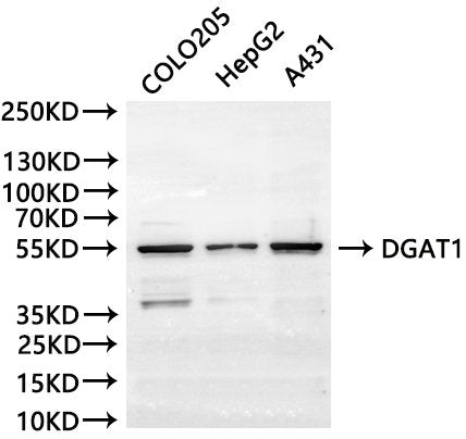 Western Blot, 
Positive WB detected in:COLO205 whole cell lysate(30µg), HepG2 whole cell lysate(30µg), A431 whole cell lysate(30µg)
All lanes: DGAT1 antibody at 1:1000
Secondary
Goat polyclonal to rabbit IgG at 1/20000 dilution
Predicted band size: 55 kDa
Observed band size: 55 kDa
Exposure time：10s