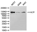 Western Blot, 
Positive WB detected in:MCF7 whole cell lysate(30µg), A549 whole cell lysate(30µg), A431 whole cell lysate(30µg)
All lanes: HLTF antibody at 1:1000
Secondary
Goat polyclonal to rabbit IgG at 1/20000 dilution
Predicted band size: 114 kDa
Observed band size: 120 kDa
Exposure time：10s