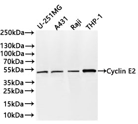 Western Blot
Positive WB detected in: U-251MG whole cell lysate(30µg) , A431 whole cell lysate(30µg) , Raji whole cell lysate(30µg) , THP-1 whole cell lysate(30µg) 
All lanes: Cyclin E2 antibody at 1:1000
Secondary
Goat polyclonal to rabbit IgG at 1/40000 dilution
Predicted band size: 47 kDa
Observed band size: 47 kDa
Exposure time：2min