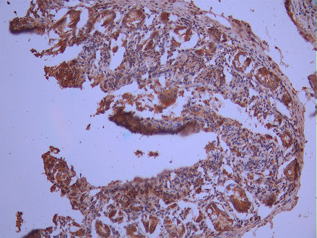 IHC image of CSB-RA048081A0HU diluted at 1:100 and staining in paraffin-embedded human small intestine tissue performed on a Leica BondTM system. After dewaxing and hydration, antigen retrieval was mediated by high pressure in a citrate buffer (pH 6.0). Section was blocked with 10% normal goat serum 30min at RT. Then primary antibody (1% BSA) was incubated at 4°C overnight. The primary is detected by a Goat anti-rabbit polymer IgG labeled by HRP and visualized using 0.05% DAB.