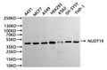 Western Blot
Positive WB detected in: A431 whole cell lysate(30µg), MCF-7 whole cell lysate(30µg), A549 whole cell lysate(30µg), HEK293 whole cell lysate(30µg), K562 whole cell lysate(30µg), SH-SY5Y whole cell lysate(30µg), THP-1 whole cell lysate(30µg)
All lanes: NUDT19 antibody at 1:1000
Secondary
Goat polyclonal to rabbit IgG at 1/40000 dilution
Predicted band size: 42 kDa
Observed band size: 42 kDa
Exposure time：2min